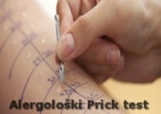 Alergološki prick test